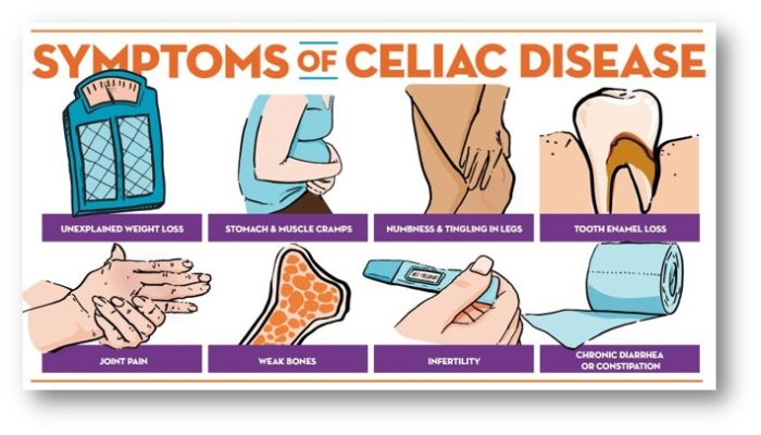 Celiac Disease - A complete guide - Symptoms and ...